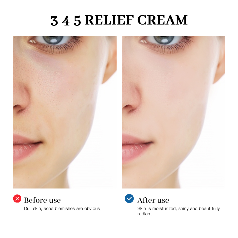 345 Relief Cream สารละลายที่คร - Retinol Cream บทวิจารณ์และราคา